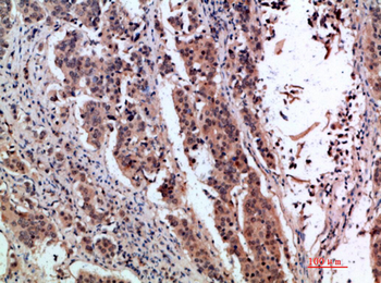 pS2 Polyclonal Antibody