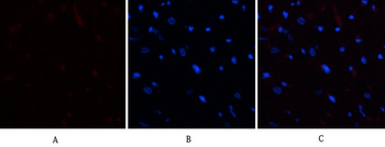 E2F-1 Polyclonal Antibody