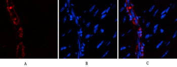 α-SMA Polyclonal Antibody