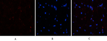 PTEN Polyclonal Antibody