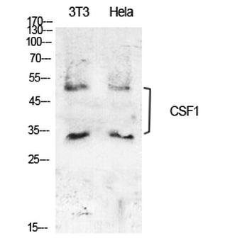 M-CSF Polyclonal Antibody