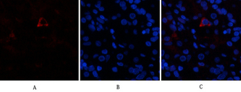 AR Polyclonal Antibody