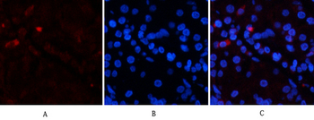 EPAS-1 Polyclonal Antibody