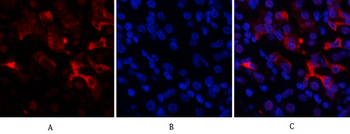 Bcl-6 Polyclonal Antibody