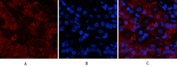 TNF-α Polyclonal Antibody