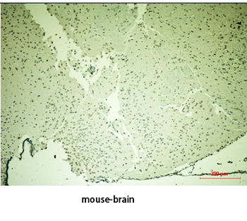 TH Polyclonal Antibody