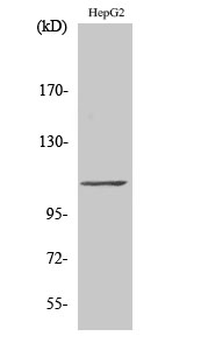 TFIIIC110 Polyclonal Antibody