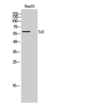 TdT Polyclonal Antibody