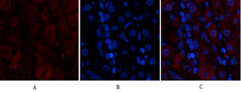 Tak1 Polyclonal Antibody