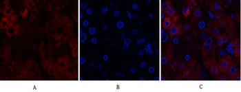 Stat1 Polyclonal Antibody