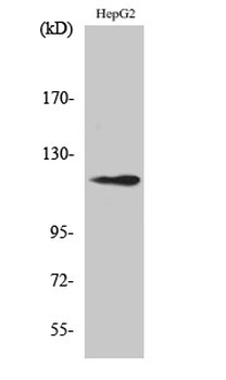 SPT16 Polyclonal Antibody