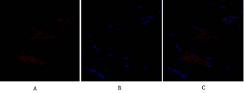 SNAI 1 Polyclonal Antibody