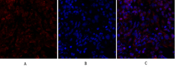 Smad4 Polyclonal Antibody