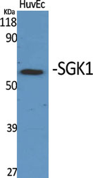 SGK1 Polyclonal Antibody