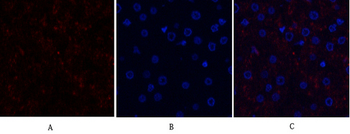 SGK1 Polyclonal Antibody