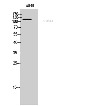 SFRS14 Polyclonal Antibody