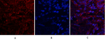 SDF-1 Polyclonal Antibody