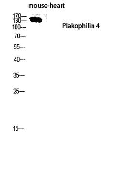 Plakophilin 4 Polyclonal Antibody