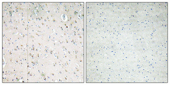 PI 3-kinase p85β Polyclonal Antibody