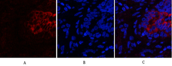 PI 3-kinase p85α/γ Polyclonal Antibody