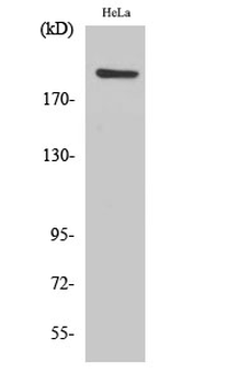 PHF3 Polyclonal Antibody