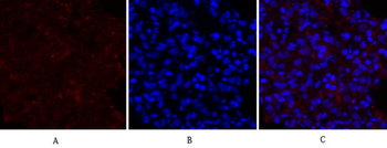 PERK Polyclonal Antibody