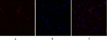 PDK1 Polyclonal Antibody
