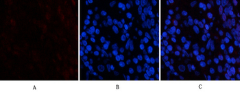 PDGF-B Polyclonal Antibody