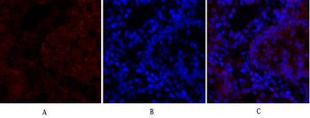 N-cadherin Polyclonal Antibody