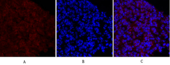 MEK-1/2 Polyclonal Antibody