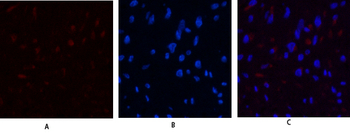 JAK3 Polyclonal Antibody