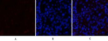 JAK2 Polyclonal Antibody