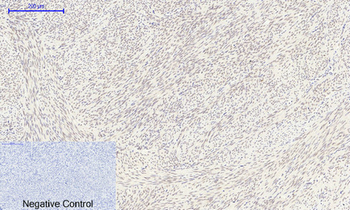 FoxO1 Polyclonal Antibody