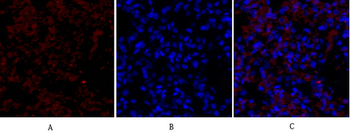 Flk-1 Polyclonal Antibody