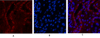 ERβ Polyclonal Antibody