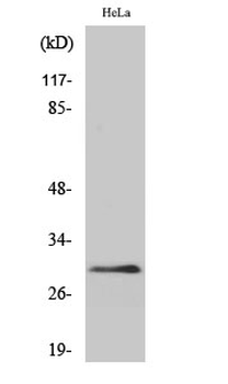 eIF3K Polyclonal Antibody
