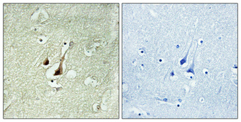 Dyrk1B Polyclonal Antibody