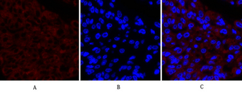 Cox-2 Polyclonal Antibody