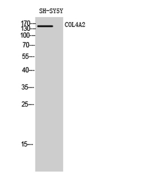 COL4A2 Polyclonal Antibody