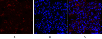 COL2A1 Polyclonal Antibody