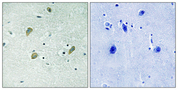 Casein Kinase Iγ1/2/3 Polyclonal Antibody