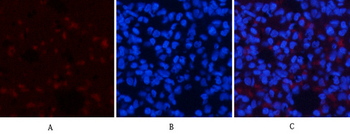AMPKα1 Polyclonal Antibody