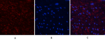 Actin β Polyclonal Antibody