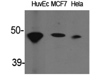 ACAT-1 Polyclonal Antibody