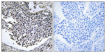 ABHD9 Polyclonal Antibody