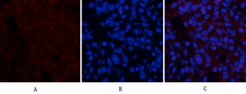 ERK 1/2 (phospho Thr202/Y204) Polyclonal Antibody