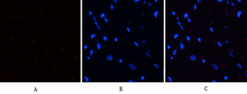 PERK (phospho Thr981) Polyclonal Antibody