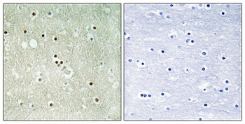 Rb (phospho Ser612) Polyclonal Antibody