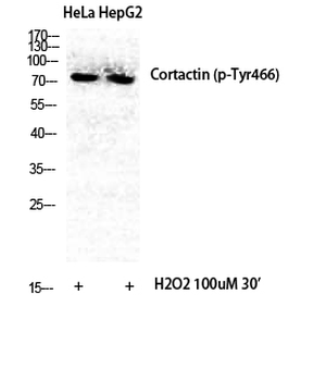 Cortactin (phospho Tyr466) Polyclonal Antibody