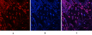 JNK1/2/3 (phospho Tyr185) Polyclonal Antibody